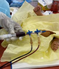 Exchange blood transfusion